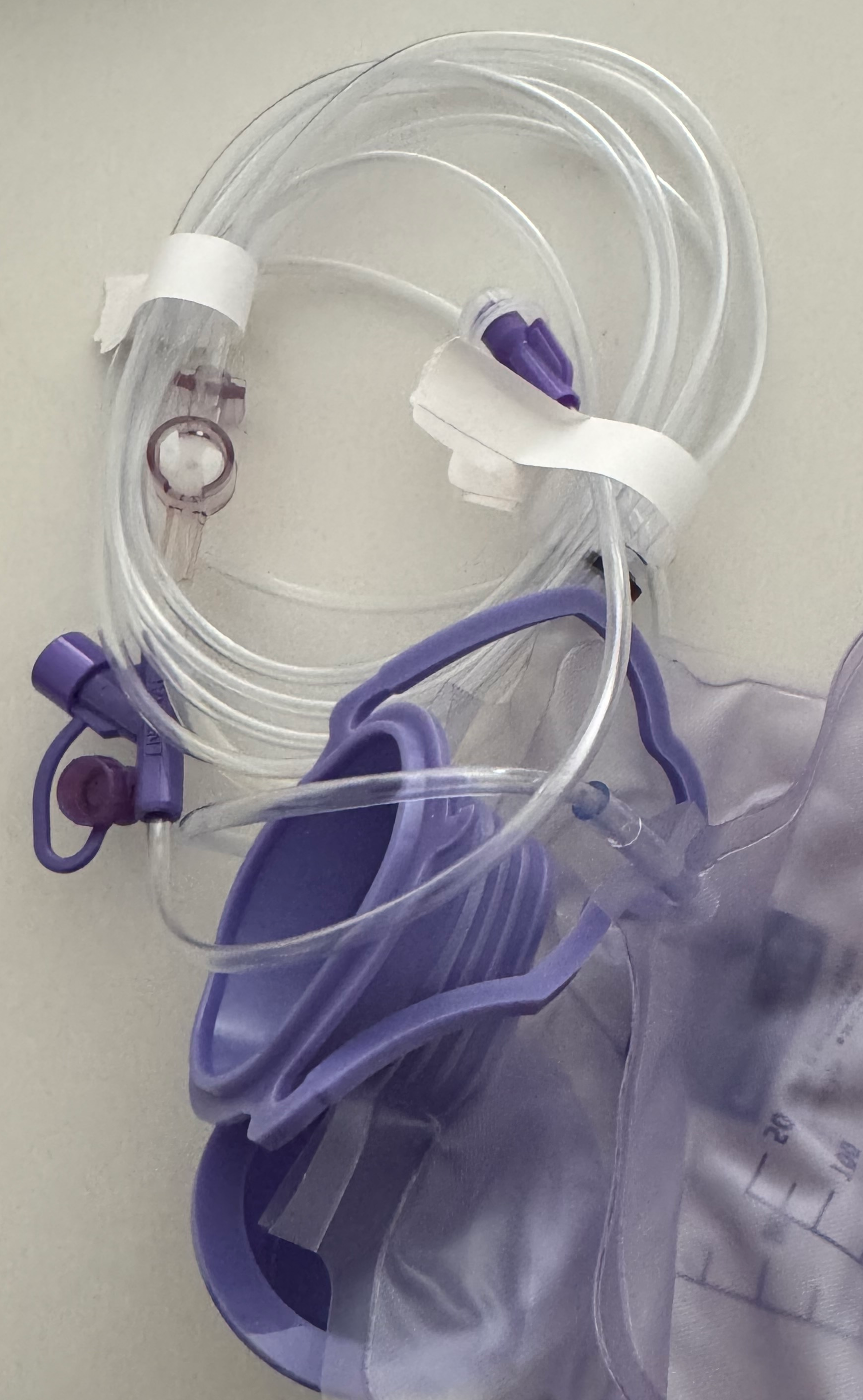 Kangaroo | ePump 1000ml Feed Set with Inline Medication Port 777106